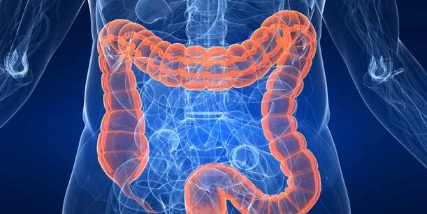 Coffee may benefit colon cancer patients