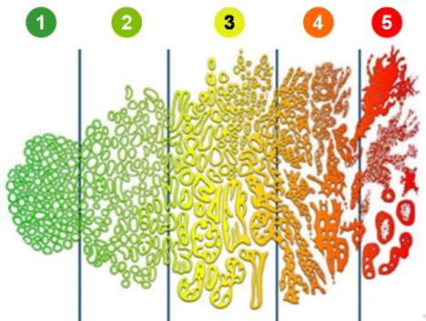 What is the Gleason score for prostate cancer?