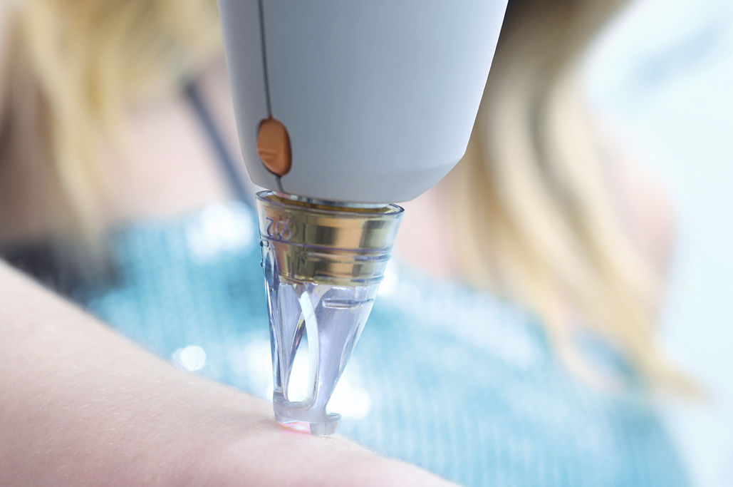 Digital Health Innovation: New Non-Invasive Skin Cancer Test