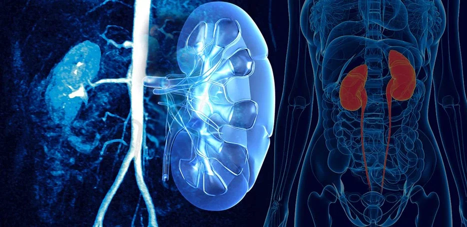 What is interstitial cystitis?