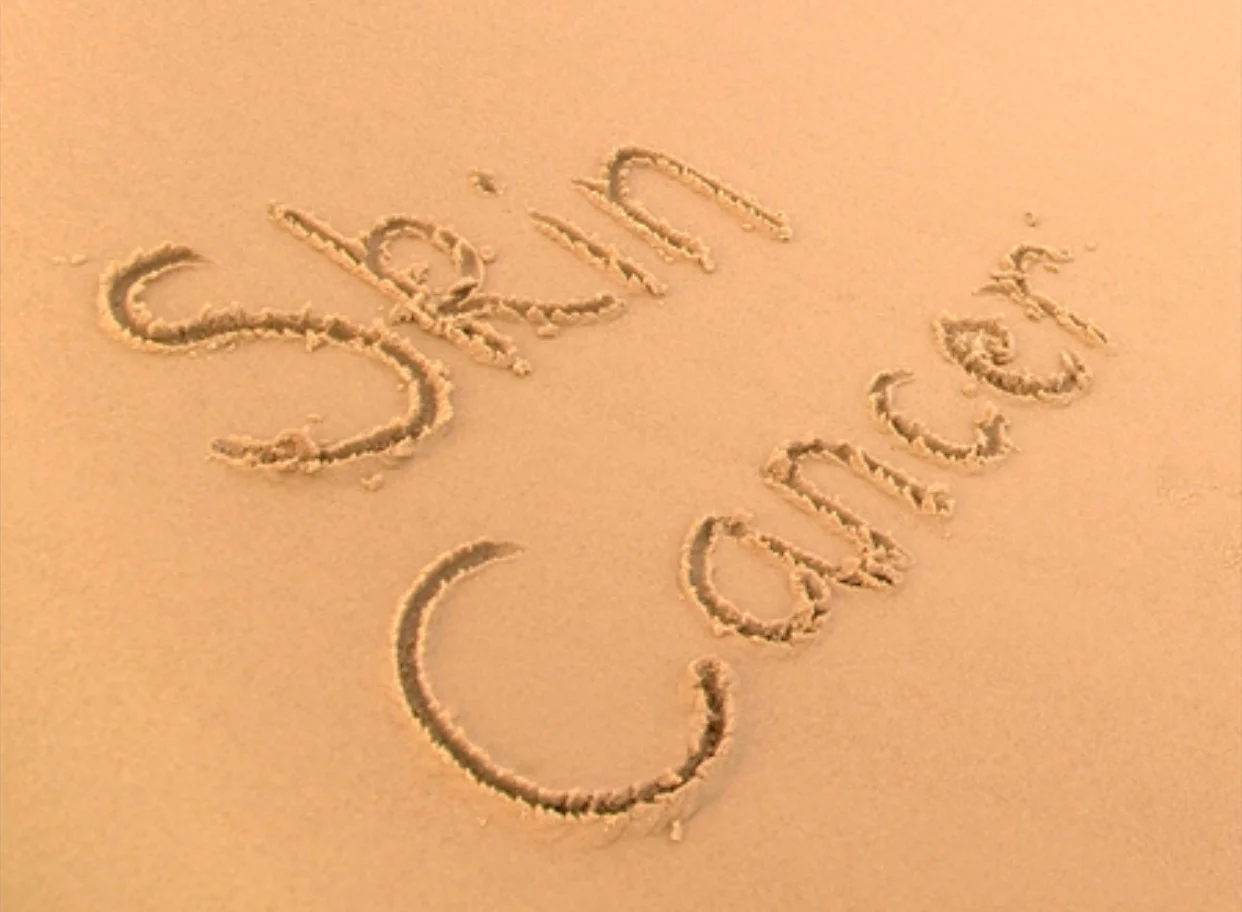 Skin cancer – why food can be an ally in preventing this common cancer