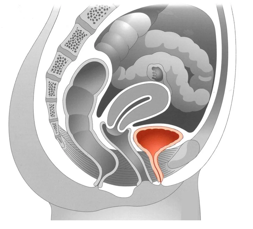 Thickness of bladder wall linked to bladder outlet obstruction
