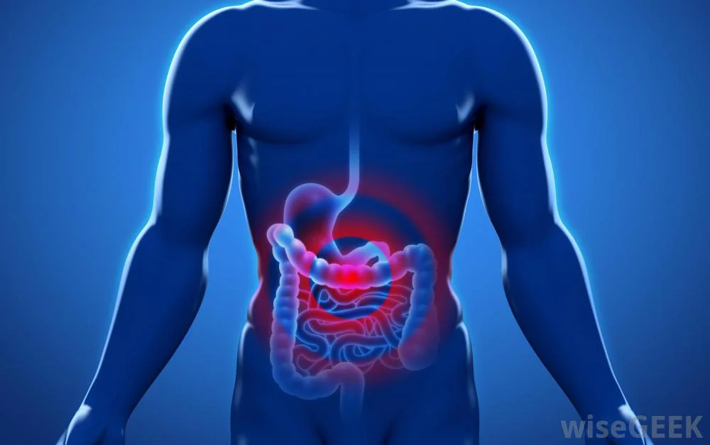 What is Peritonitis?