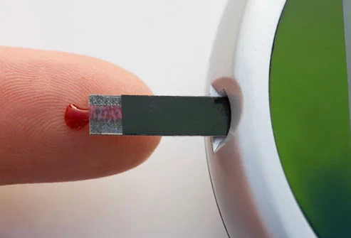 Controlling Blood Sugar May Help Prevent Dementia