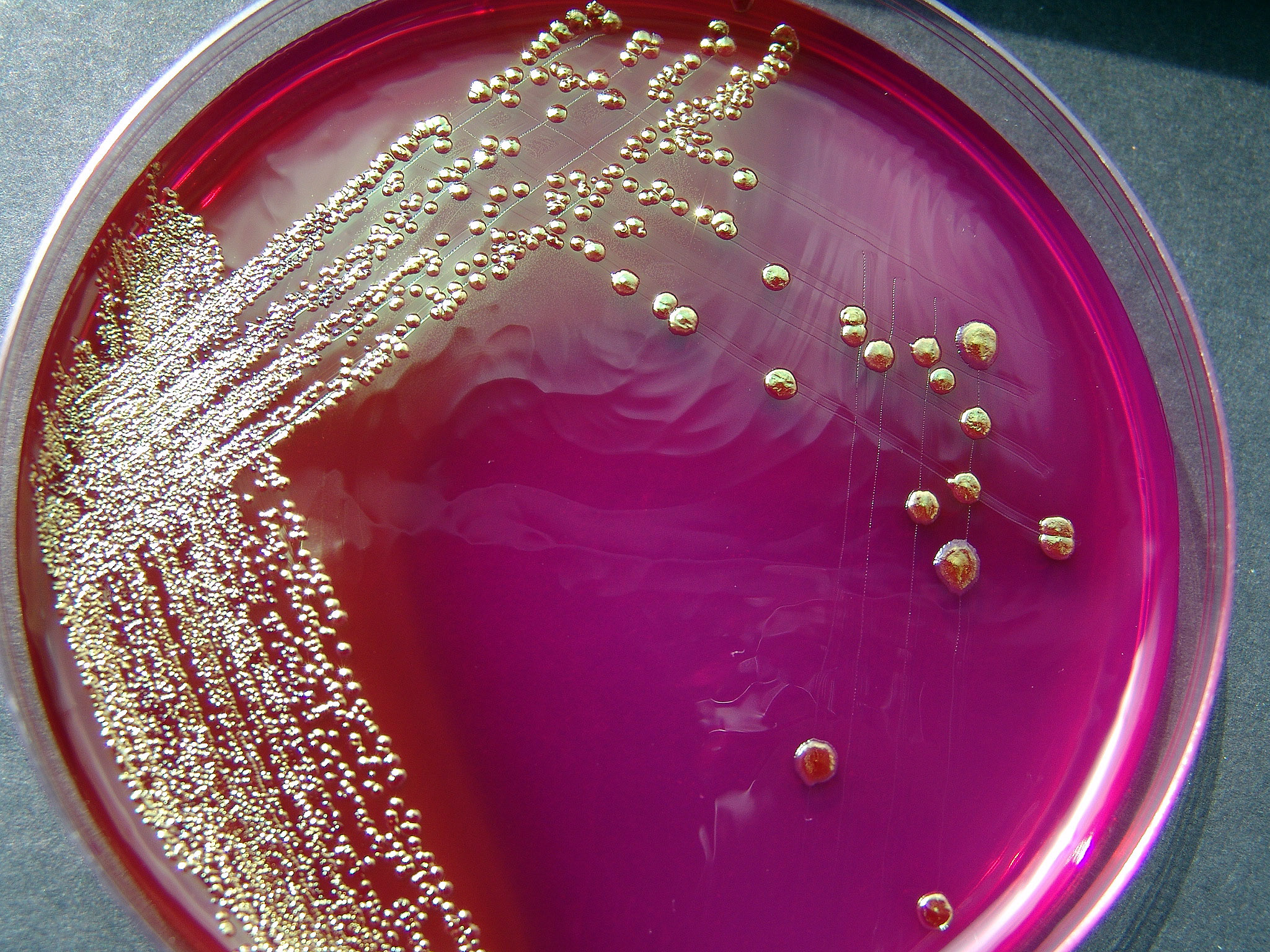 E. Coli Infection: What Americans Need to Know