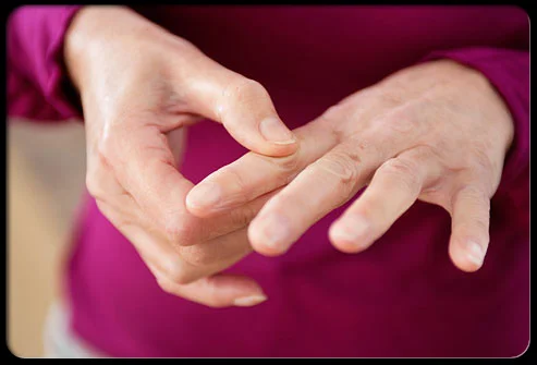 Lupus Affects Women More Than Men