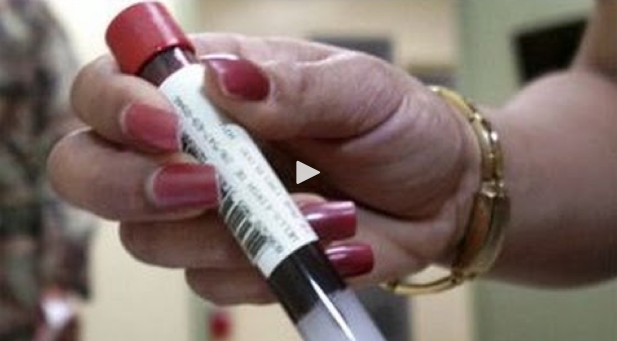  Blood test reveals every virus you ever had?