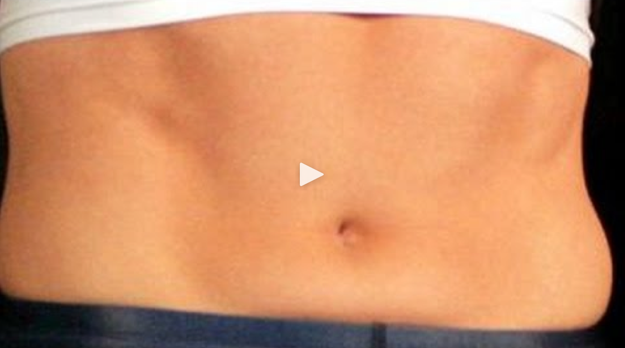  Study: Americans' gut bacteria lack diversity