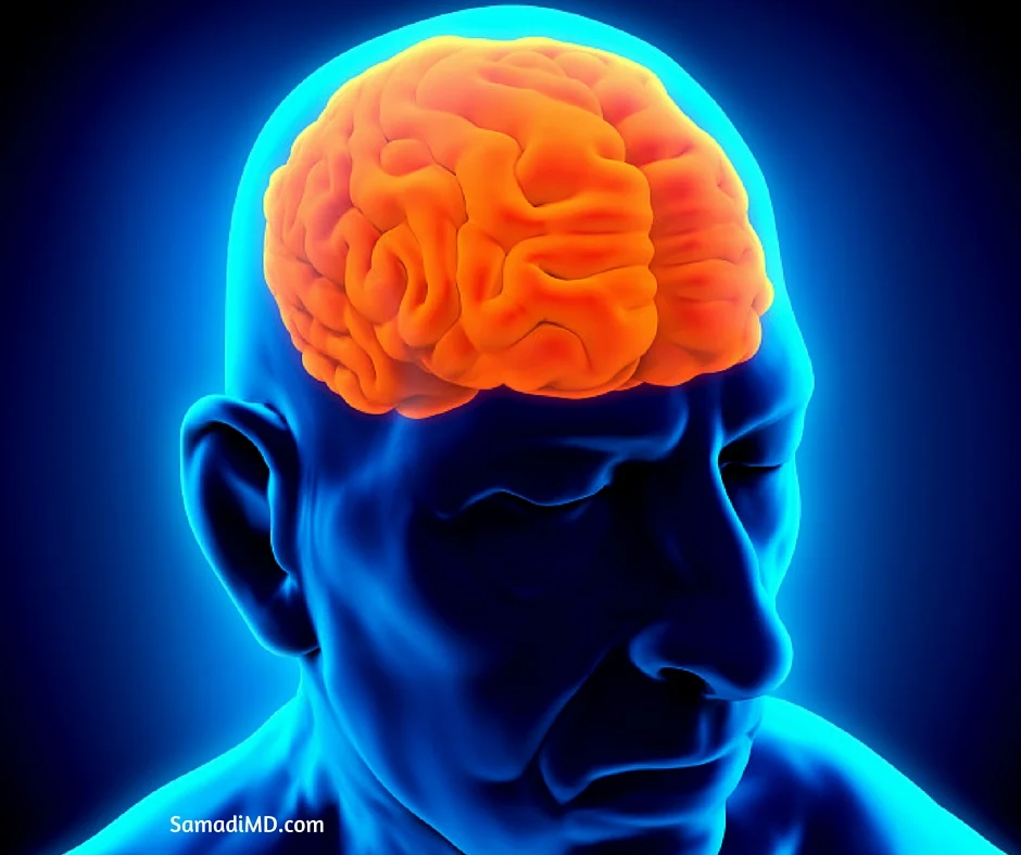 Minerals minimizing the risk of a stroke