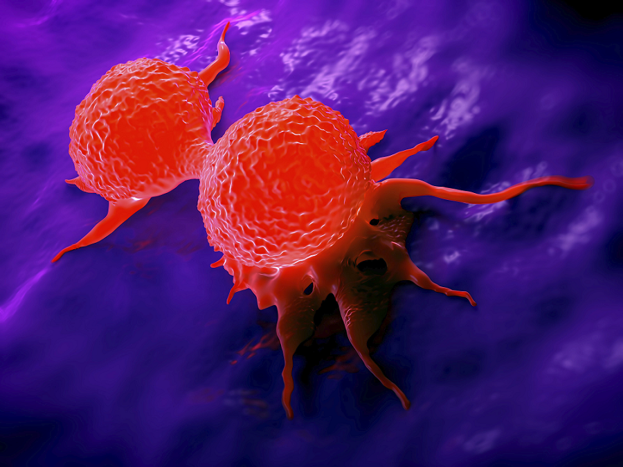 Breast Cancer Screening Guidelines