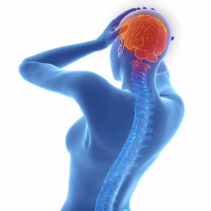 Migraine Triggers vs. Symptoms