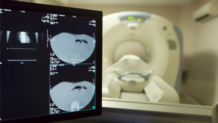 Imaging technology for prostate cancer