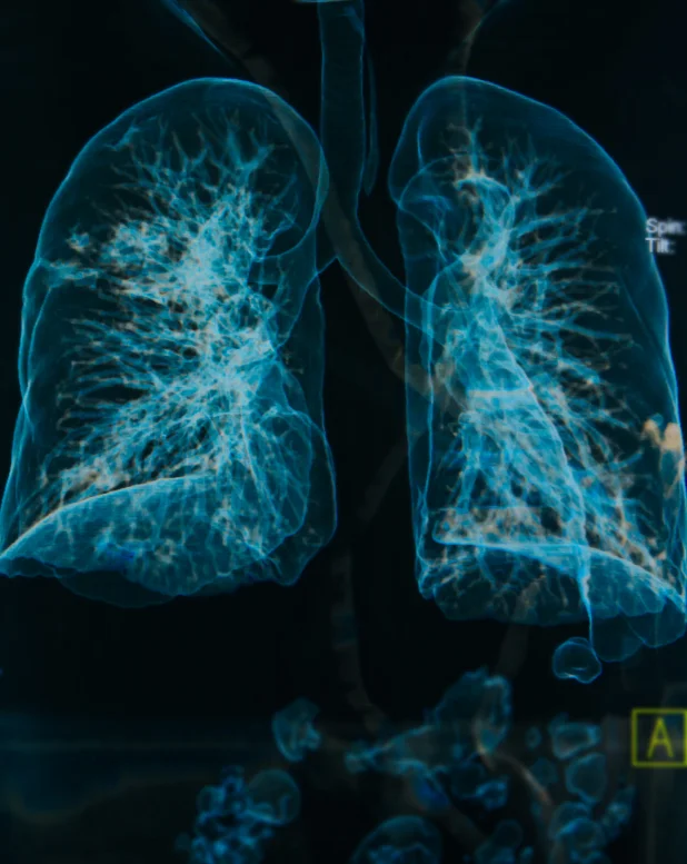 How to Diagnose COPD, early