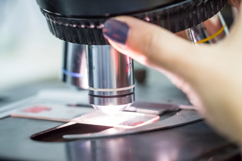 Do you have an elevated PSA but negative biopsy?