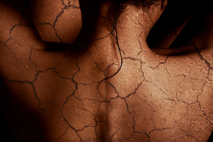 How to avoid dry skin in the winter