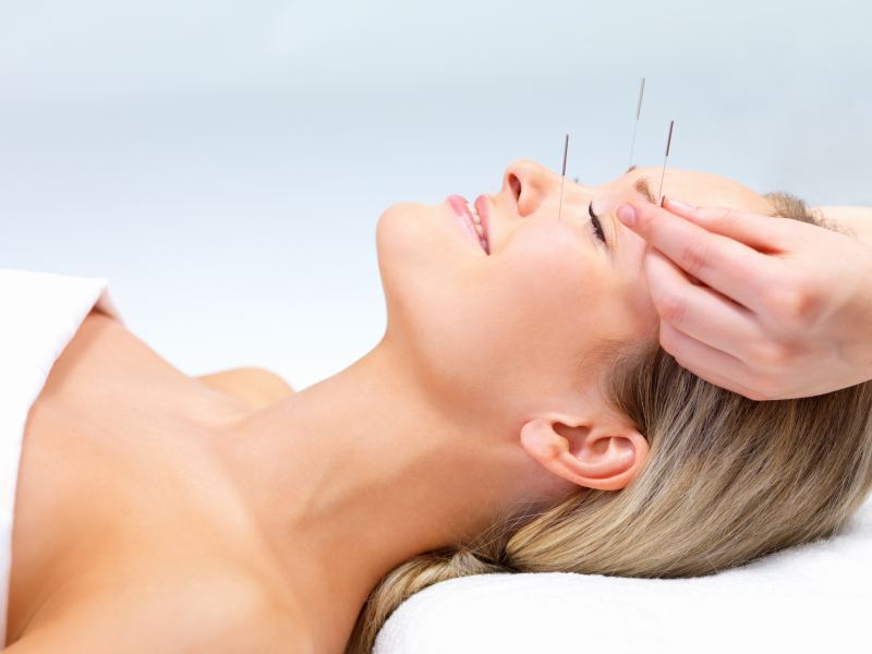 Acupuncture for Treating Pain