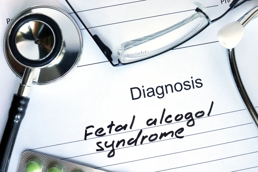 What is Fetal Alcohol Syndrome?