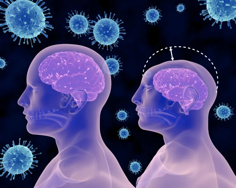 Is Zika Virus a Threat to You?