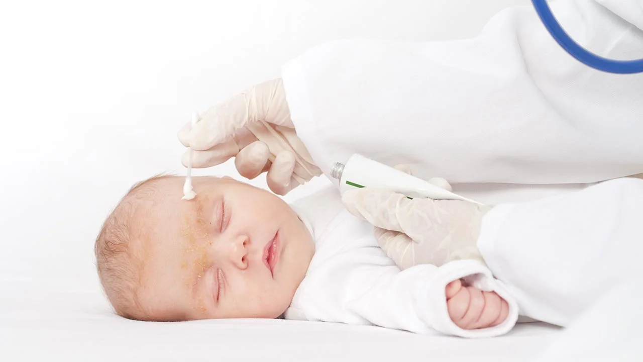 What If Your Baby Has Got Rashes?