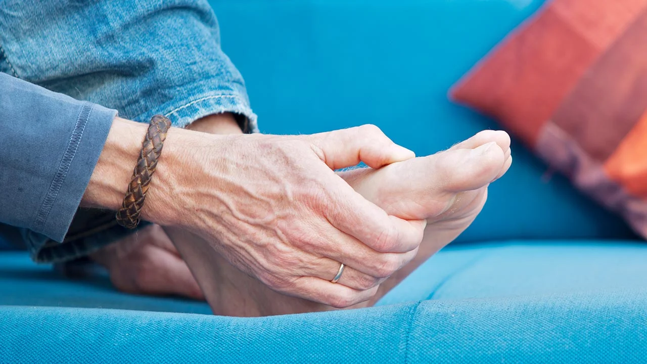 Gout: Not Just for Fictional Characters