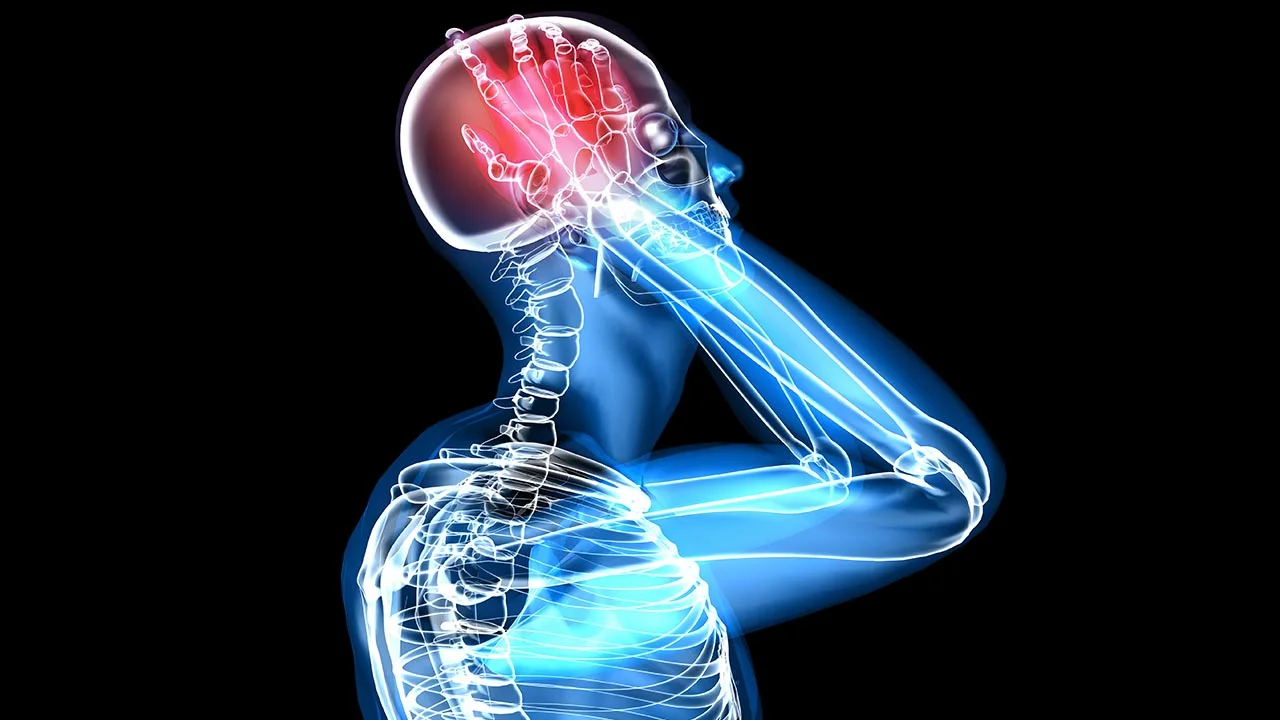 What is a Migraine?