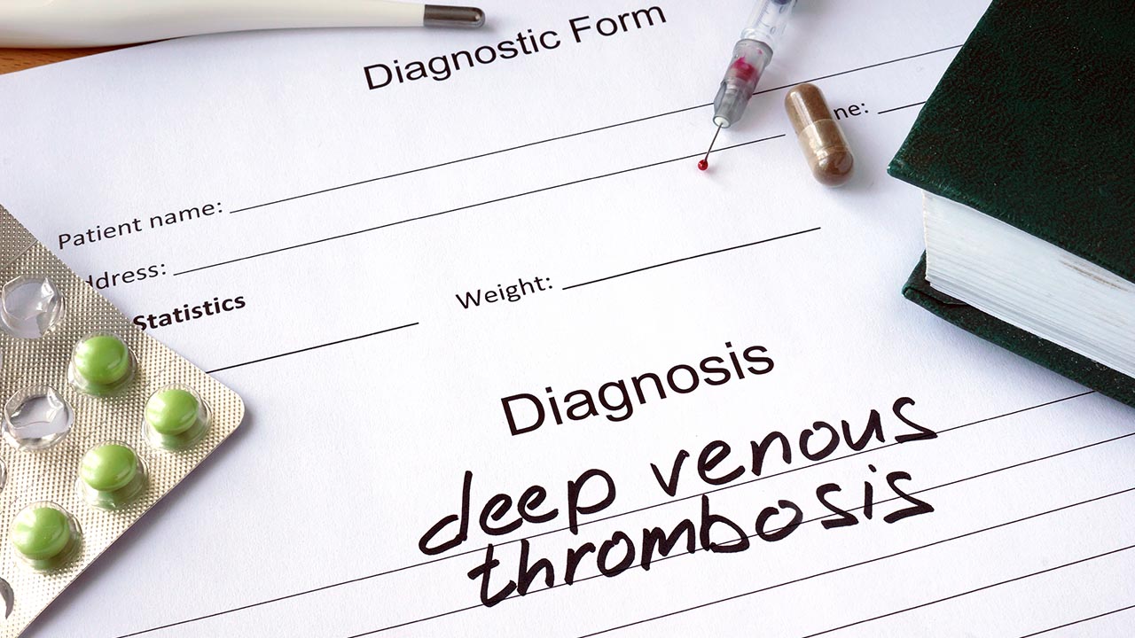What You Need to Know About DVT’s