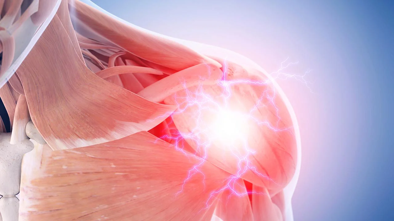 Fighting Tendinosis with Ultrasound