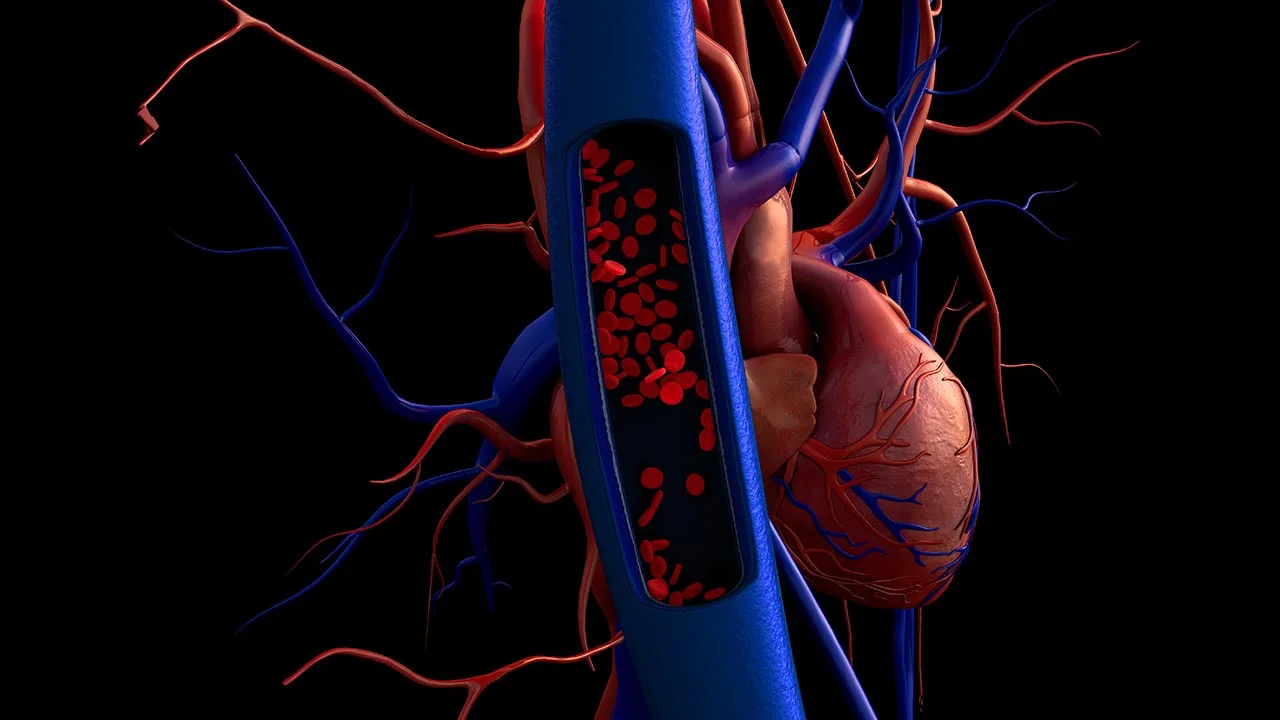 Is There Early Treatment for Coronary Artery Disease? 	