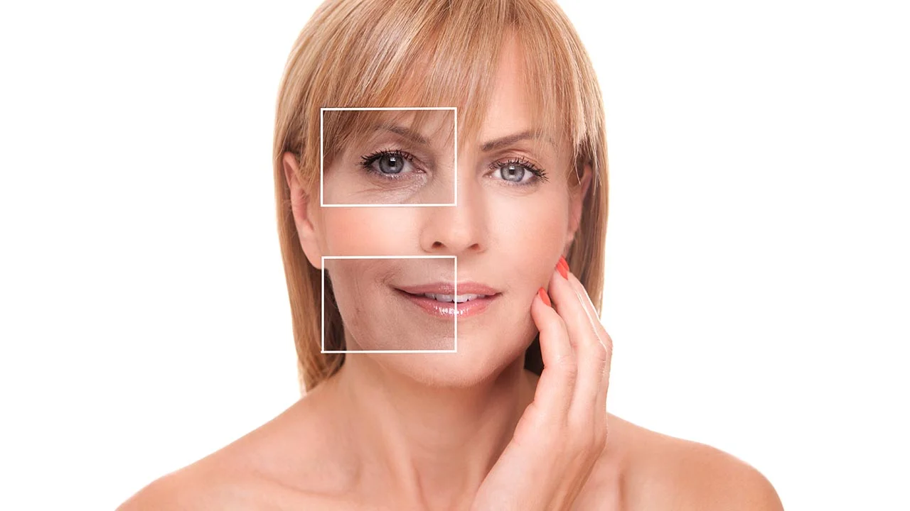 Botox Pros and Cons