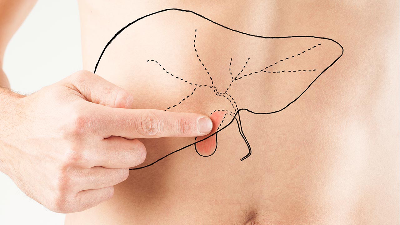 What you need to know about gallbladder stones