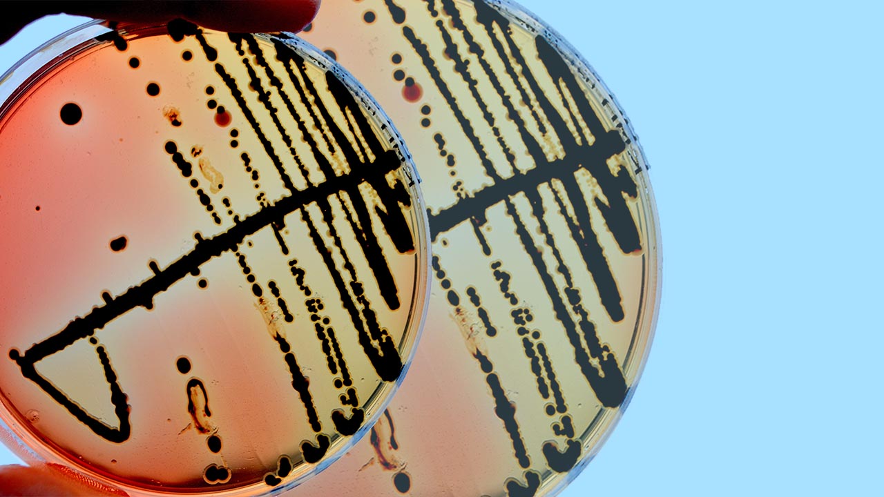How To Protect Yourself Against Salmonella