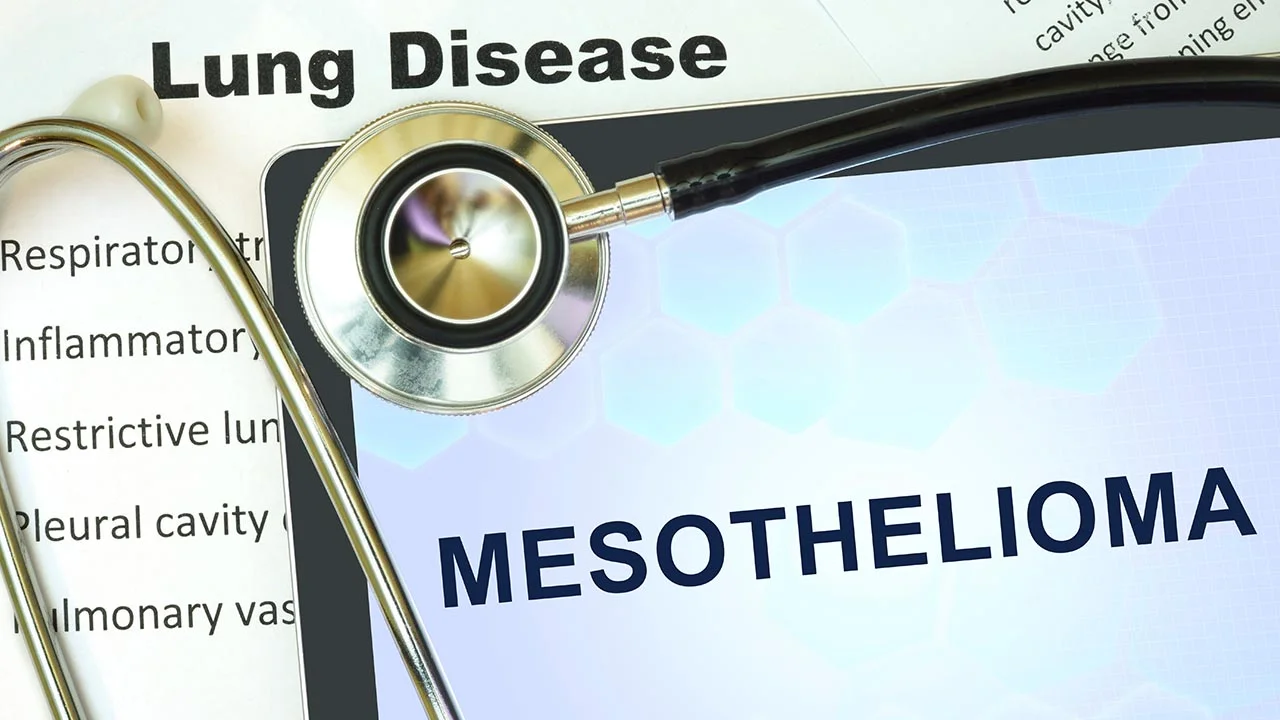 The “Asbestos Disease:” Mesothelioma