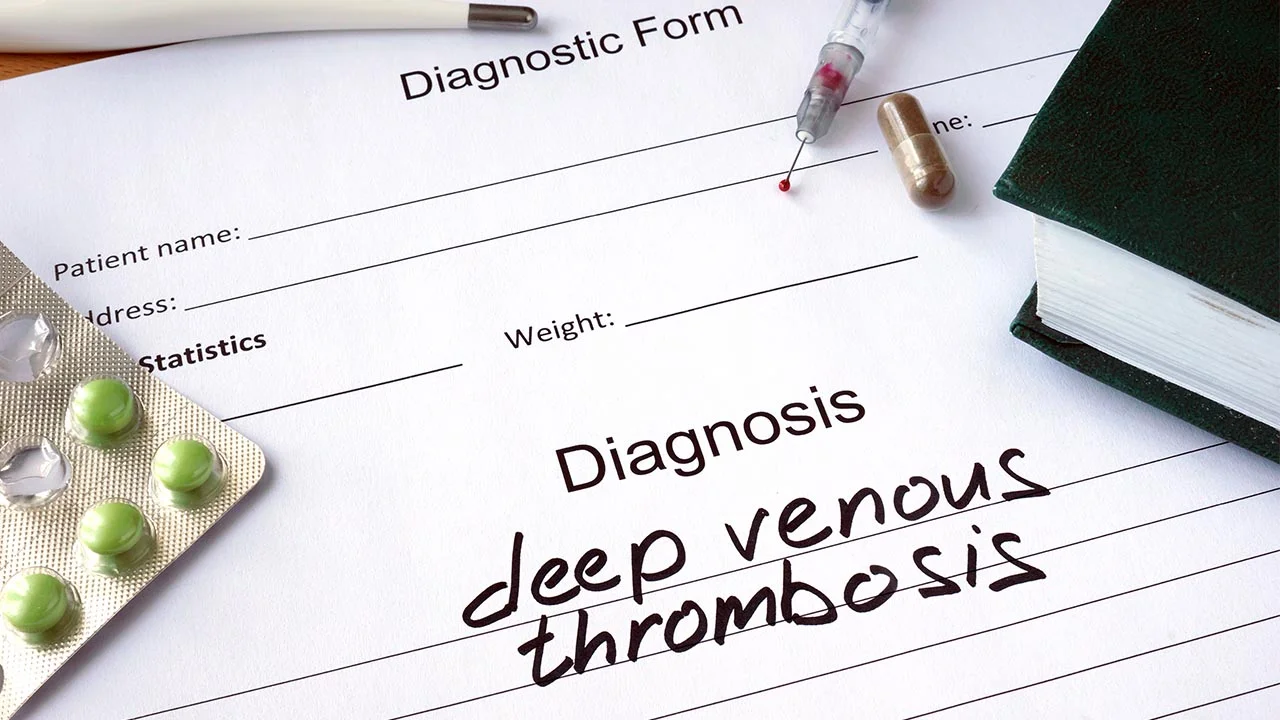 Deep Vein Thrombosis: A Hidden Killer