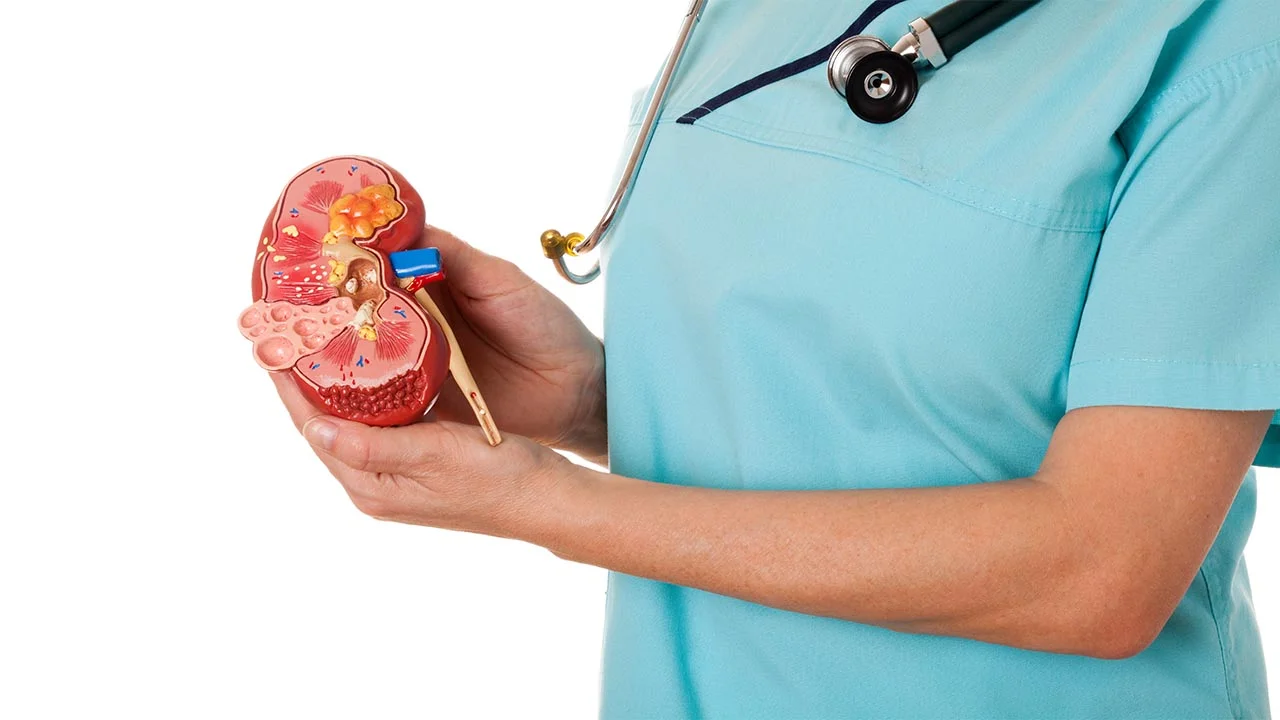 Treating Kidney Stones