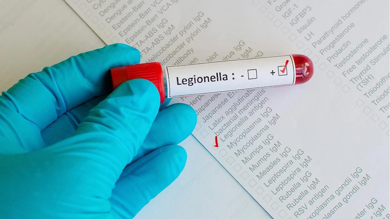 Legionnaires Disease: Not That Exotic