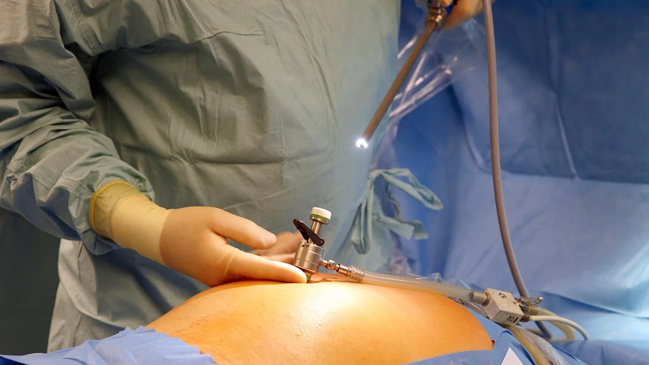 Building a Better Laparoscope – with Dragonflies