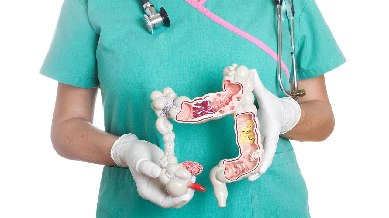 What's Ahead If You Get Colorectal Cancer.jpg