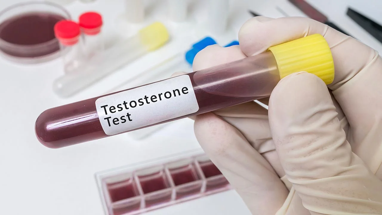 Is Your Testosterone Level High Enough?