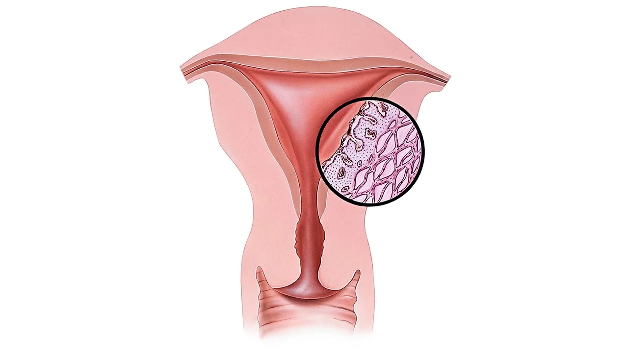 Can Birth Control Pills Treat Fibroids?