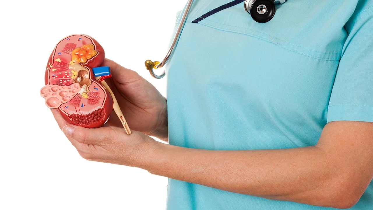 Keeping the kidneys free of kidney stones