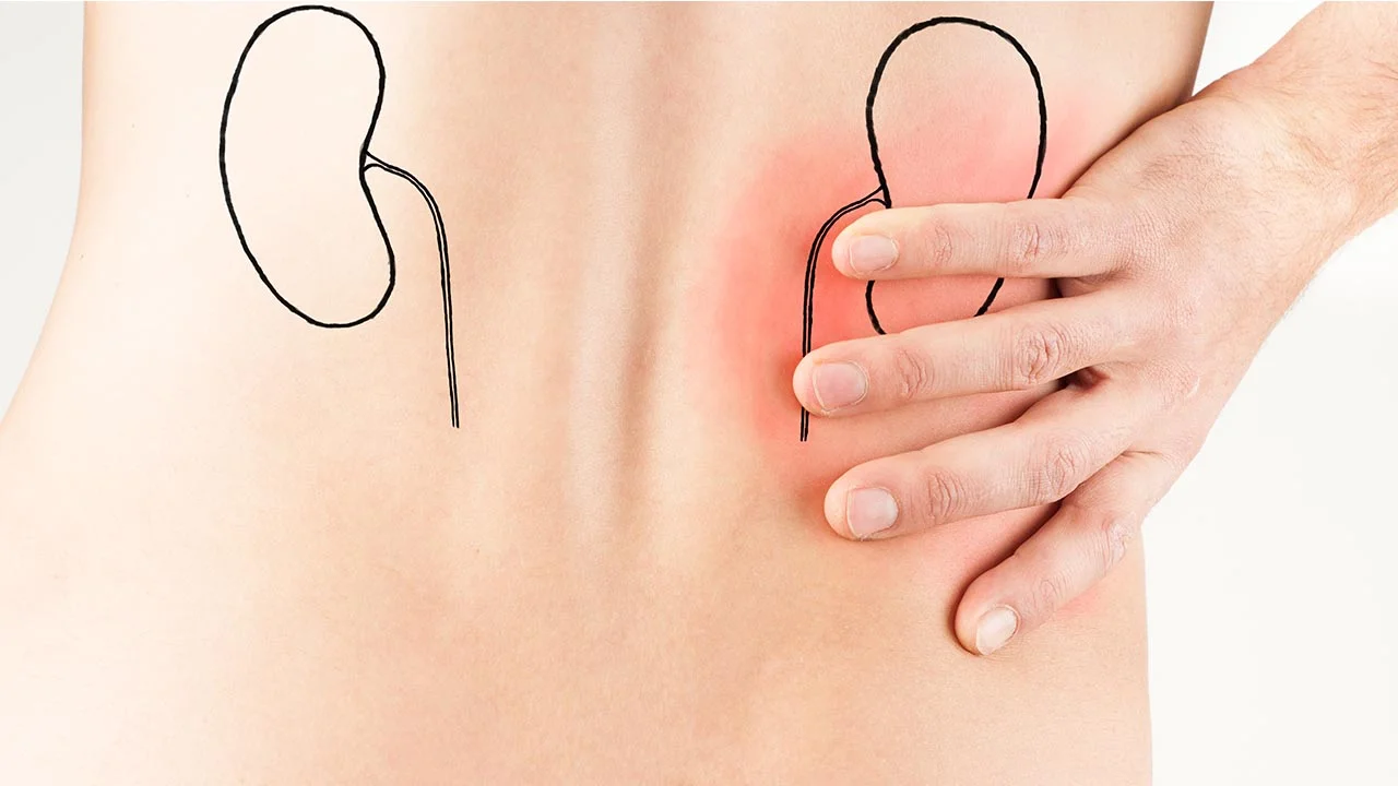 Nephrotic Syndrome