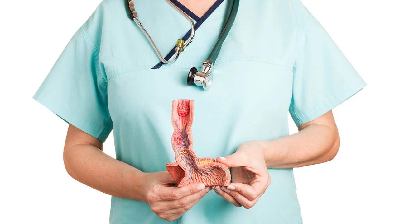 How To Have A Healthy Esophagus