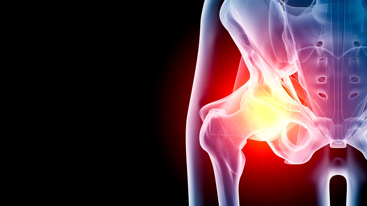 Pelvic Inflammatory Disease