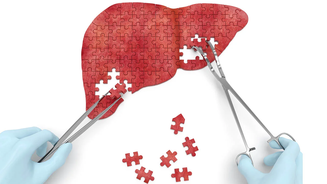 Fatty Liver Disease