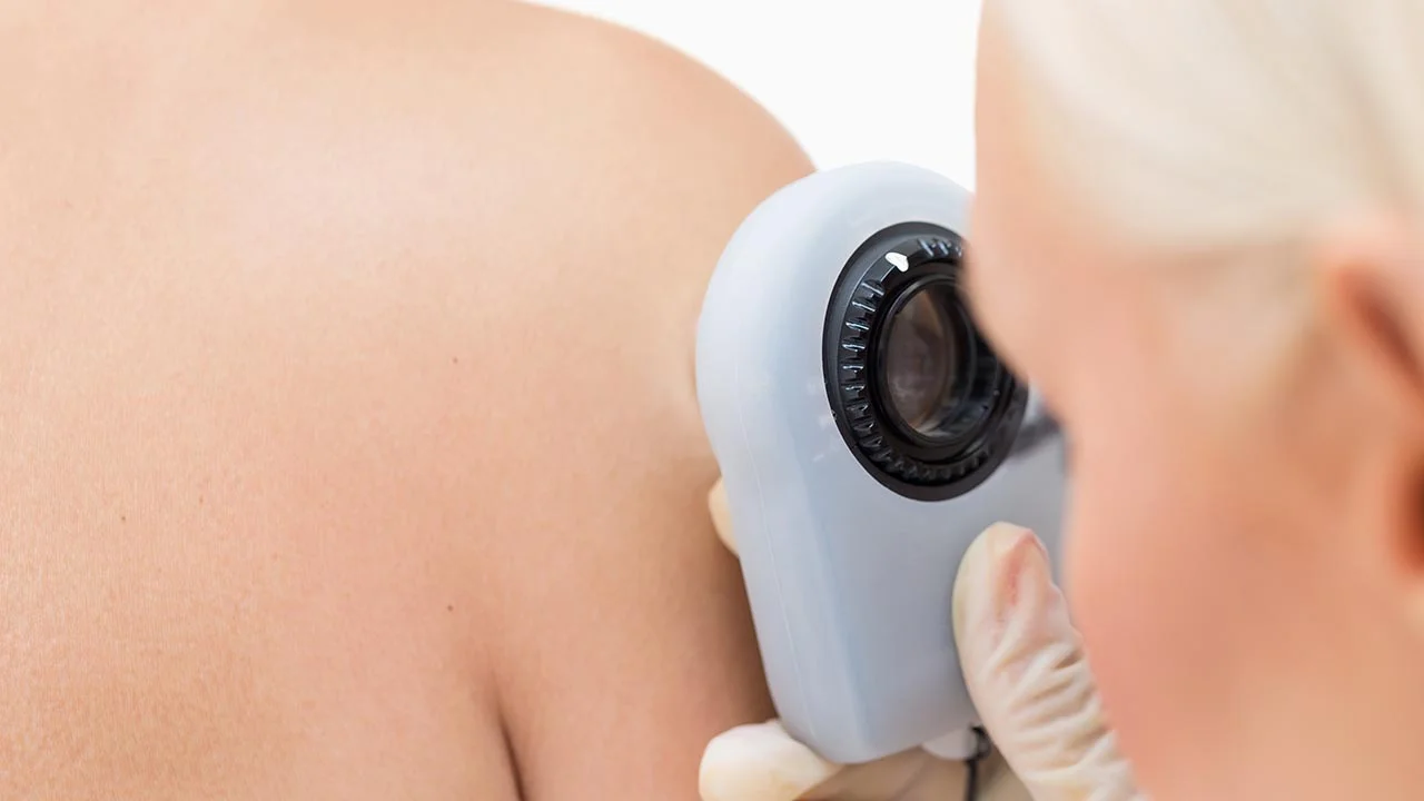 Partnering For Spotting Skin Cancer 