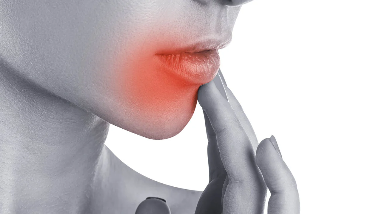 Can Herpes Be Eliminated?