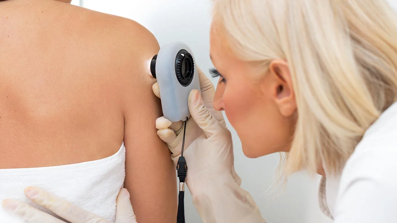 The New Treatment for Skin Cancer
