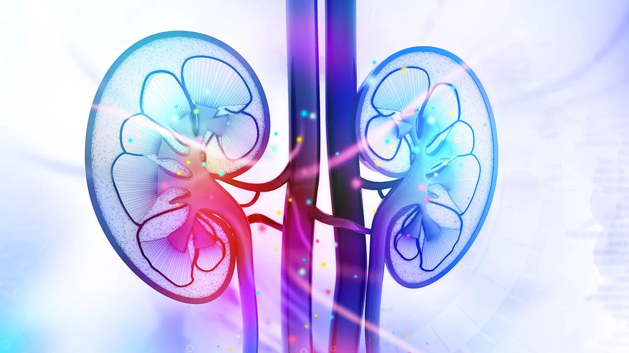 New Treatment for Kidney Stones