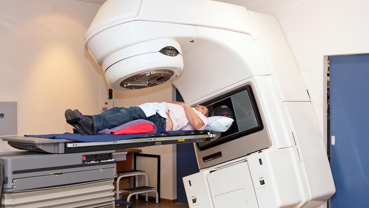 Radiation Prostate Cancer Signatures