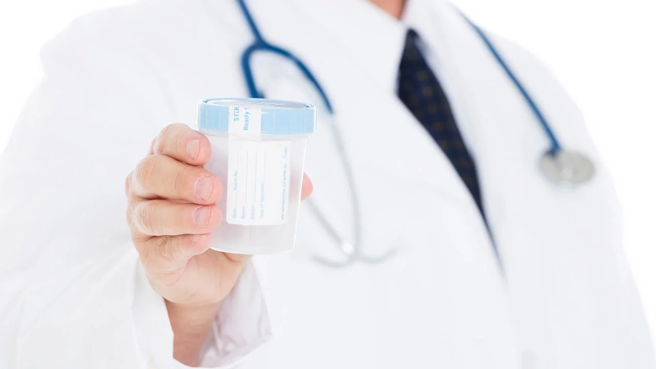 Urine Test for Prostate Cancer